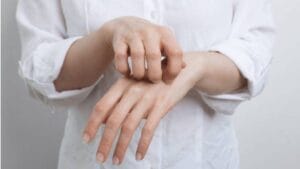 Cilt hastalıkları arasında oldukça yaygın olan uyuz, birçok insanın hayatını