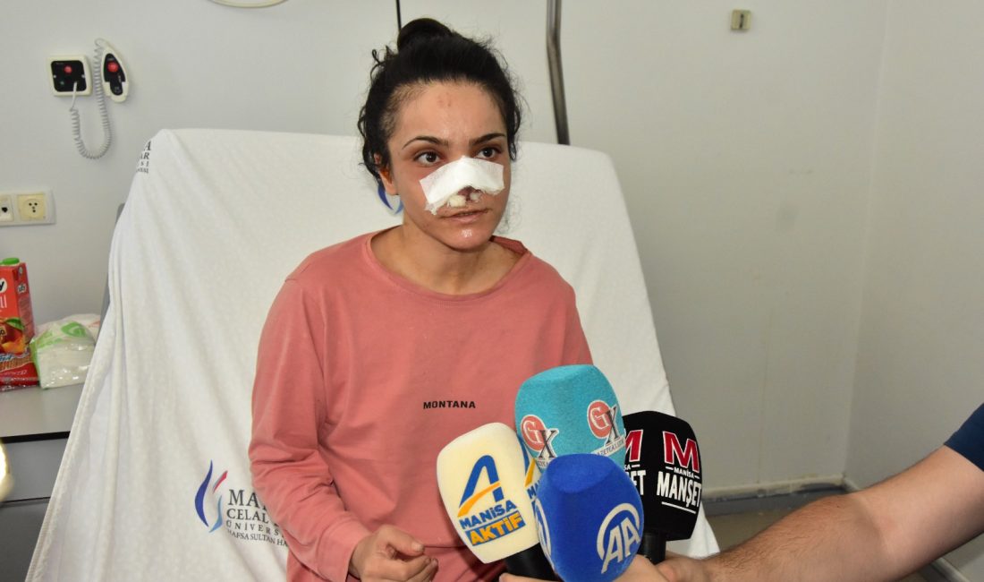 Manisa'nın Turgutlu ilçesinde eşi tarafından darp edilerek burnu ısırılıp koparılan